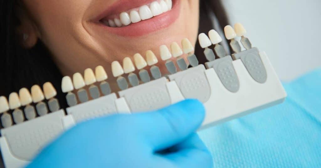 אילו סוגי כתרים לשיניים נחשבים הכי עמידים